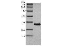 SDS-PAGE of Recombinant Human Tumor Necrosis Factor-beta/TNFSF1
