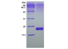 SDS-PAGE of Recombinant Human soluble Tumor Necrosis Factor-Related Apoptosis-inducing Ligand Receptor-2/TNFRSF10B