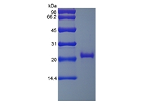 SDS-PAGE of Recombinant Human soluble Tumor Necrosis Factor Receptor Type II/TNFRSF1B
