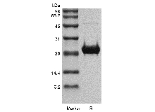 SDS-PAGE of Recombinant Human Fibroblast Growth Factor 19