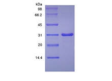 SDS-PAGE of Recombinant Human Insulin-like Growth Factor-Binding Protein 7
