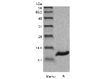 SDS-PAGE of Recombinant Human Persephin