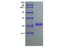 SDS-PAGE of Recombinant Human Osteoprotegerin
