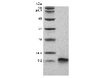 SDS-PAGE of Recombinant Human Beta-defensin 3