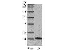 SDS-PAGE of Recombinant Human Beta-defensin 5