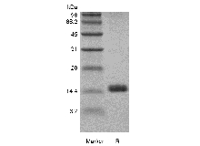SDS-PAGE of Recombinant Rat Granulocyte-Macrophage Colony Stimulating Factor