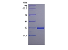 SDS-PAGE of Recombinant Rat Leukemia Inhibitory Factor