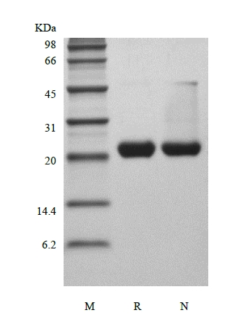SDS-PAGE of Recombinant Rat Ciliary Neurotrophic Factor