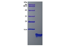 SDS-PAGE of Recombinant Rat Beta-defensin 4