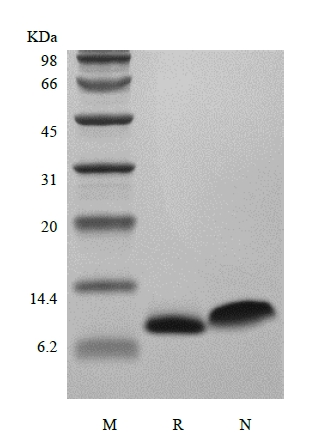 SDS-PAGE of Recombinant Human Regulation upon Activation Normal T cell Express Sequence/CCL5