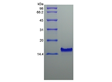 SDS-PAGE of Recombinant Human Thymus Expressed Chemokine/CCL25
