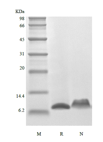 SDS-PAGE of Recombinant Murine Regulation upon Activation Normal T cell Express Sequence/CCL5