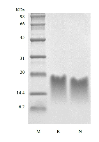SDS-PAGE of Recombinant Human Parathyroid Hormone 39-84 Asp 76