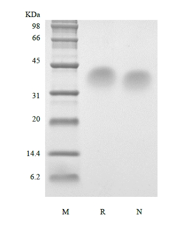 SDS-PAGE of Recombinant Human Parathyroid Hormone 53-84