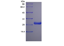 SDS-PAGE of Recombinant Rat Prolactin