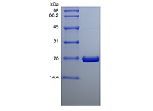 SDS-PAGE of Recombinant Human Ubiquitin-conjugating Enzyme E2 C, His