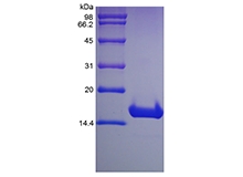 SDS-PAGE of Recombinant Human Cyclin-Dependent Kinase Inhibitor 2A, Isoform 1