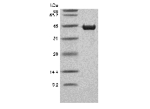 SDS-PAGE of Recombinant Human Cardiac muscle troponin T