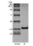 SDS-PAGE of Recombinant Human Interleukin-4 GMP