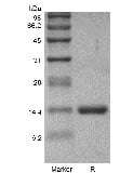 SDS-PAGE of Recombinant Human Granulocyte-Macrophage Colony Stimulating Factor GMP