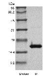 SDS-PAGE of Recombinant Human Interferon-gamma GMP